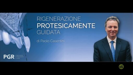 Osteocom Rigenerazione Protesicamente Guidata - Paolo Casentini (italiano)