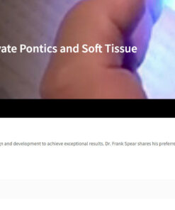 Classic Collection: Ovate Pontics and Soft Tissue
