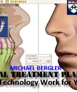 PENN Virtual Treatment Planning - Michael Bergler