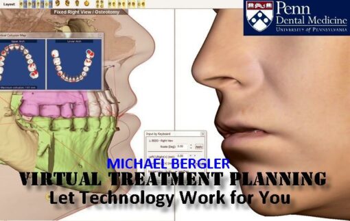 PENN Virtual Treatment Planning - Michael Bergler