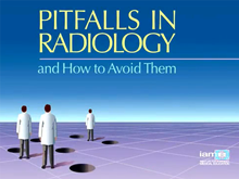PITFALLS IN RADIOLOGY
