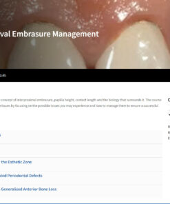 SPEAR Papilla and Gingival Embrasure Management