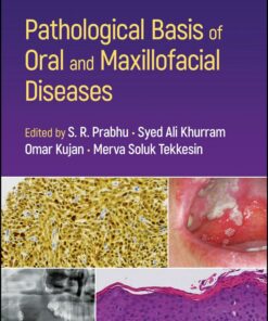 Pathological Basis of Oral and Maxillofacial Diseases / S R Prabhu, Syed Ali Khurram, Omar Kujan, Merva Soluk Tekkesin (2025) PDF Original 