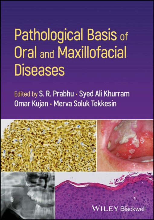 Pathological Basis of Oral and Maxillofacial Diseases / S R Prabhu, Syed Ali Khurram, Omar Kujan, Merva Soluk Tekkesin (2025) PDF Original 