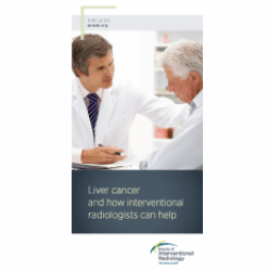 Patient Information Brochure - Liver Cancer