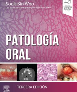 Patología oral, 3rd Edition (Original PDF from Publisher)