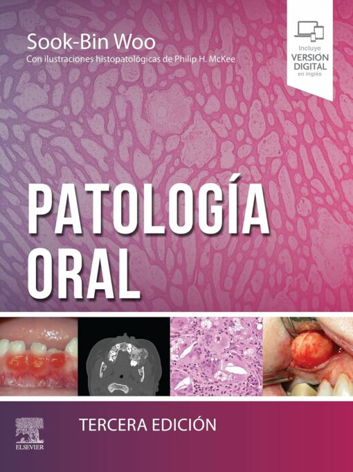 Patología oral, 3rd Edition (Original PDF from Publisher)