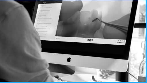 Peg Lateral Incisor Restoration Course