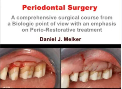 Donato Dental Systems Periodontal Surgery: A Comprehensive Surgical Course