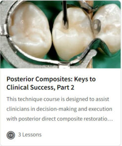 Posterior Composites: Keys to Clinical Success, Part 2