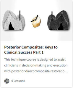 Posterior Composites: Keys to Clinical Success Part 1