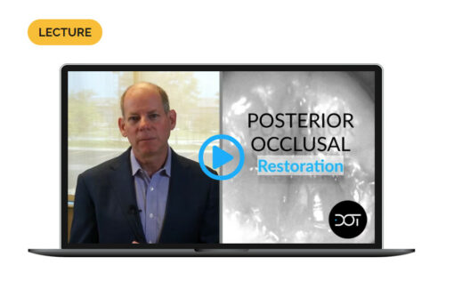 Posterior Occlusal Restorations