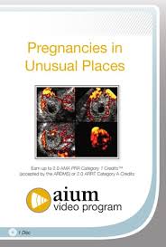 Pregnancies in Unusual Places