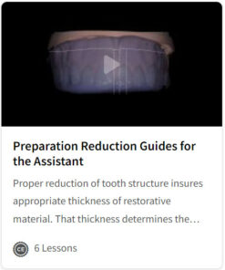 Preparation Reduction Guides for the Assistant