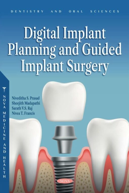 Digital Implant Planning and Guided Implant Surgery 2023 Original PDF