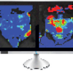 Prostate MRI: A Practice-Based Approach