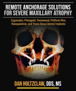 Remote Anchorage Solutions for Severe Maxillary Atrophy: Zygomatic Implants, Pterygoid Implants, Transnasal Implants, Piriform Rim Implants, Nasopalatine Implants, and Trans-Sinus Dental Implants Textbook Binding