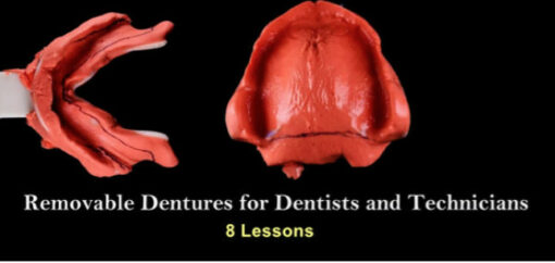 Removable Dentures for Dentists and Technicians