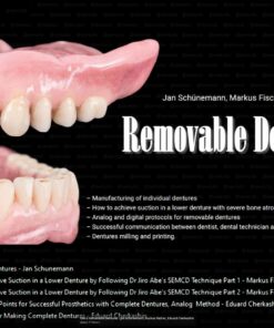 OHI-S Removable Dentures - Jan Schünemann, Markus Fischer, Eduard Cherkashin