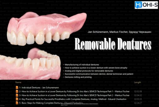 OHI-S Removable Dentures - Jan Schünemann, Markus Fischer, Eduard Cherkashin