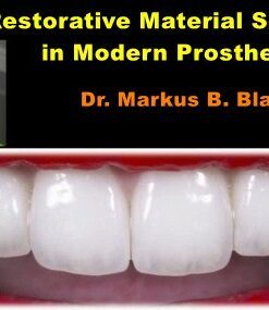 Restorative Material Selection in Modern Prosthetics