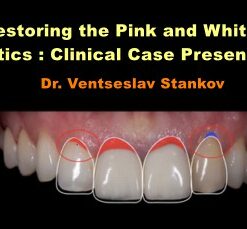 Restoring the Pink and White Esthetics: Clinical Case Presentation