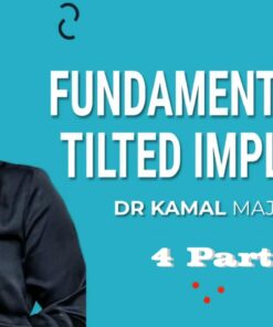 RipeGlobal Fundamentals in Tilted Implants - Kamal Majumdar
