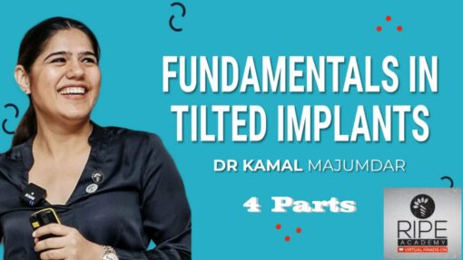 RipeGlobal Fundamentals in Tilted Implants - Kamal Majumdar