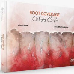 Root Coverage – Challenging Concepts