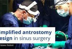 Simplified antrostomy design in sinus surgery