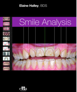 Smile Analysis 1st Edition Original PDF