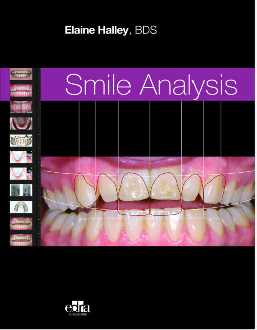 Smile Analysis 1st Edition Original PDF