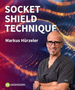 osteocom Socket Shield Technique 2025