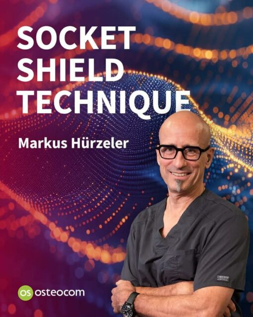 osteocom Socket Shield Technique 2025