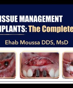 Soft Tissue Management for Implants, The Complete Course - Ehab Moussa