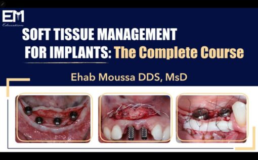 Soft Tissue Management for Implants, The Complete Course - Ehab Moussa