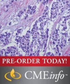 Soft Tissue Tumors