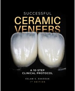 Successful Ceramic Veneers: A 10-Step Clinical Protocol 2023 Original PDF
