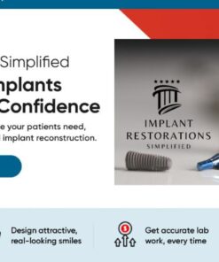 Implant Restorations Simplified