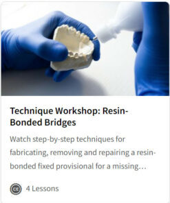 Technique Workshop: Resin-Bonded Bridges