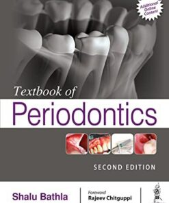 Textbook of Periodontics 2nd Edition