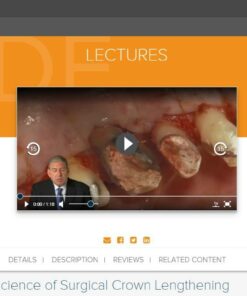 gIDE ondemand lectures - The Art and Science of Surgical Crown Lengthening  