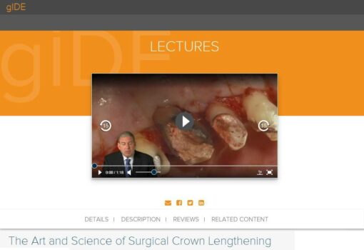 gIDE ondemand lectures - The Art and Science of Surgical Crown Lengthening  
