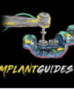 Implant Ninja .The Implant Guides 101 Course