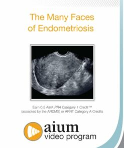 The Many Faces of Endometriosis