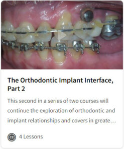 The Orthodontic Implant Interface, Part 2