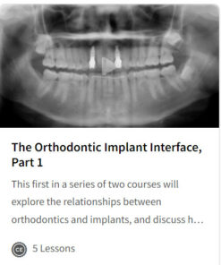 The Orthodontic Implant Interface, Part 1