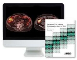 The Radiology M and M Meeting: Misinterpretations, Misses, and Mimics