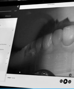 The Smile Design and Smile Preview