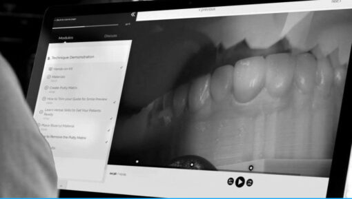 The Smile Design and Smile Preview
